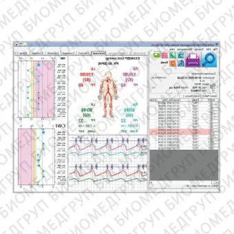 Медицинское программное обеспечение VSS50