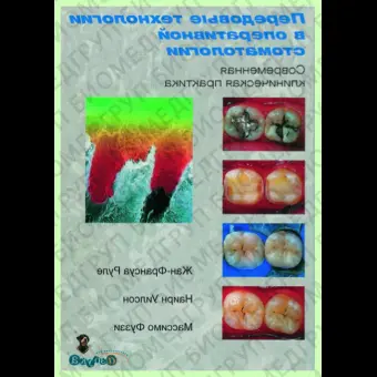 Передовые технологии в оперативной стоматологии / Ж. Руле