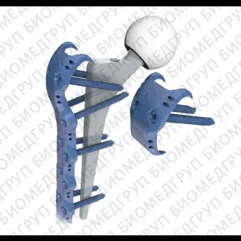 Компрессионная костная пластина для перипротезного перелома бедра 7.0 ChLP