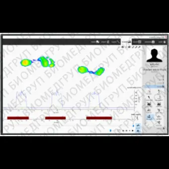 Программное обеспечение для лечения заболеваний стоп v9 Scientific