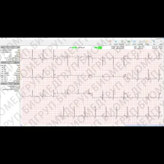 Программное обеспечение для электрокардиографии LUMED ECG MANAGER