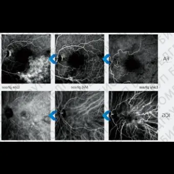Офтальмоскоп ОКТ Mirante