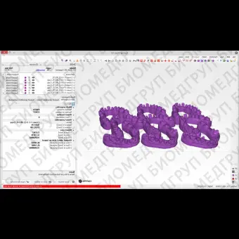 Программное обеспечение для стоматологии Slicer V2