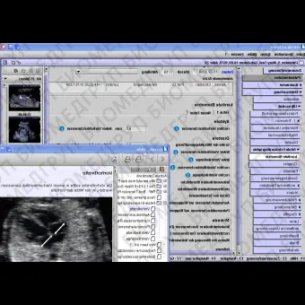 Медицинское программное обеспечение Gynaecology