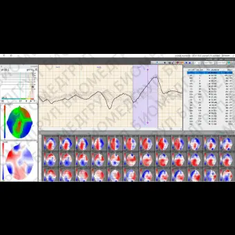 ЭЭГсистема 32 канала BRAINTEST PLUS