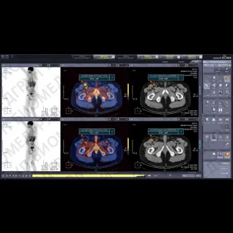 Программное обеспечение для медицинских снимков Xelis Fusion