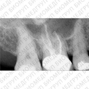 FONA CDR powered by SCHICK  система компьютерной стоматологической радиографии
