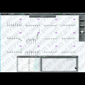 Электрокардиограф для спокойного состояния TeleCardio