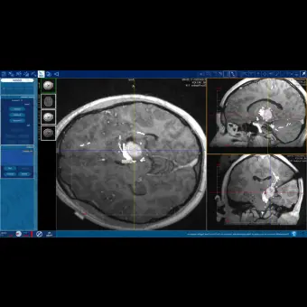 Программное обеспечение для медицинских снимков NeuroBlate  SoftwareTM NeuroBlate 