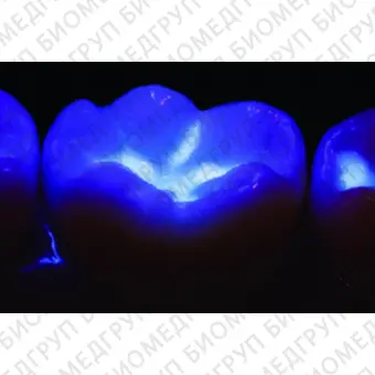 VALO Blacklight  насадка Блэклайт для определения флуоресценции композитов