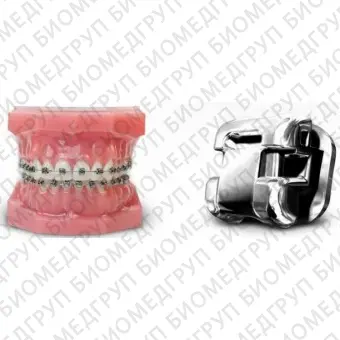Damon Q брекет ортодонтический, паз 022 на левый латеральный резец верхней челюсти 22 зуб
