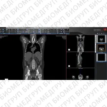 Программное обеспечение для медицинских снимков SUITESTENSA RIS PACS