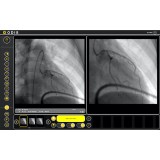 Программное обеспечение для медицинских снимков ODIS